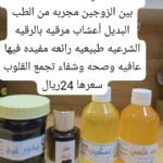 المجموعة التي تساهم في استعادة الرومانسية بين الزوجين